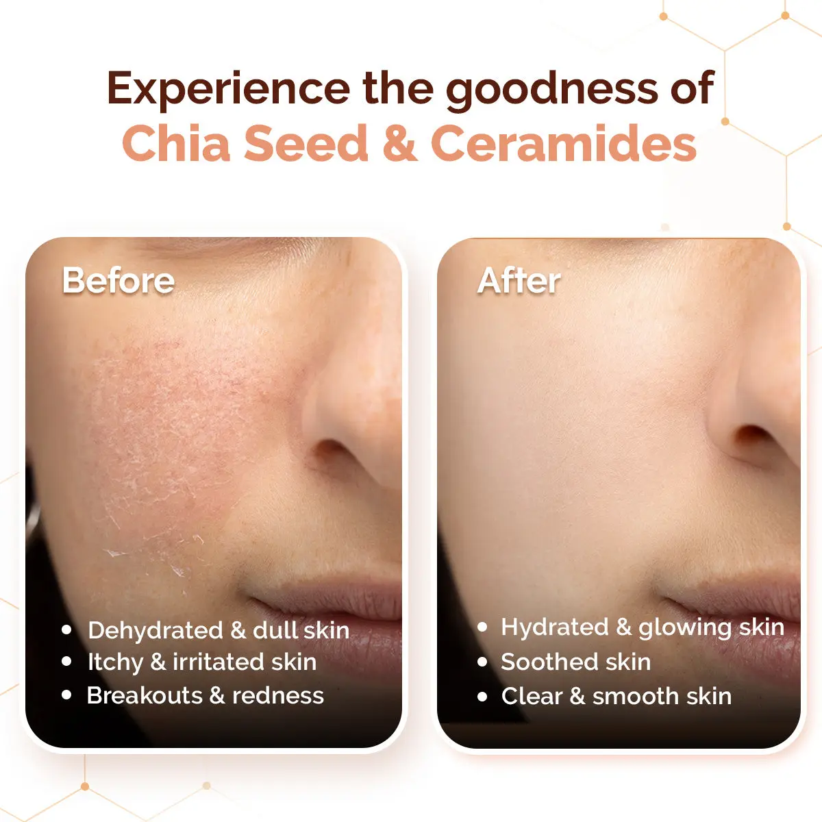 Chia Calming Moisturizer - Image 7