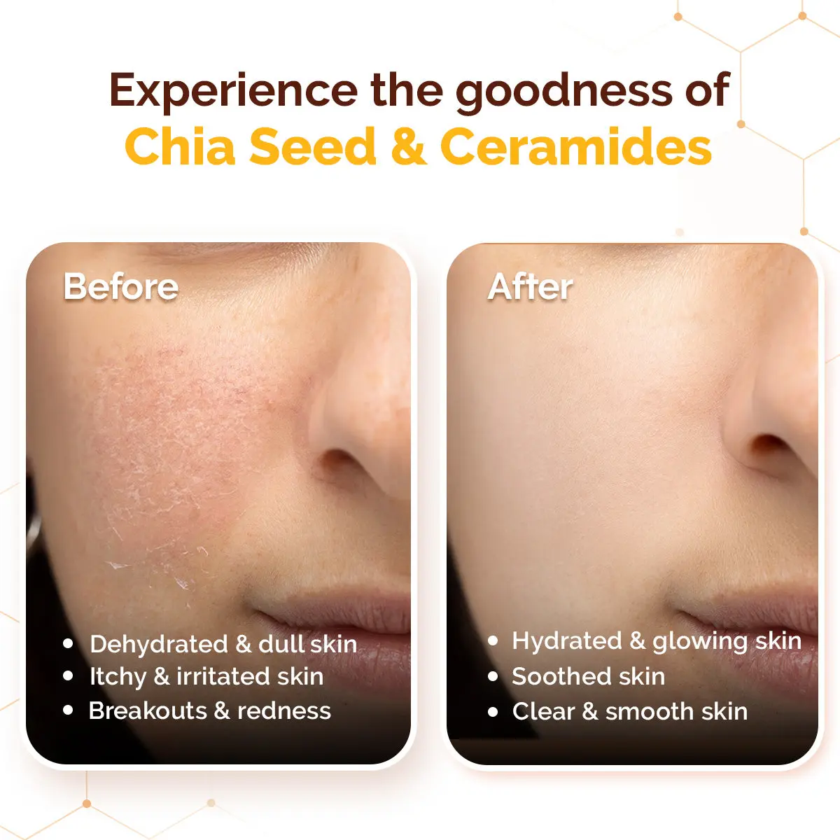 Chia Calming Sunscreen - Image 7