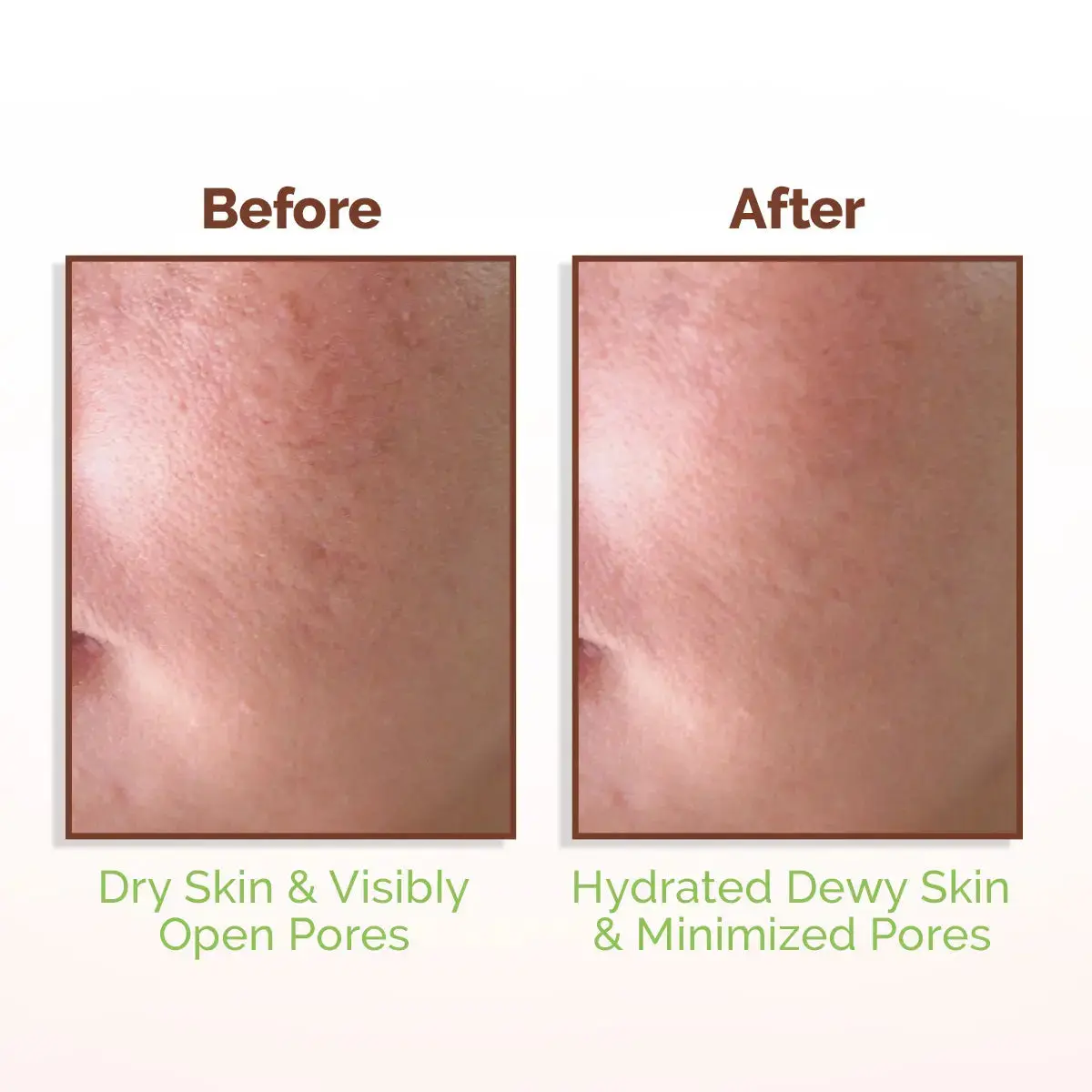 Mamaearth Rice Water Dewy Face Toner 150 ml - Image 5