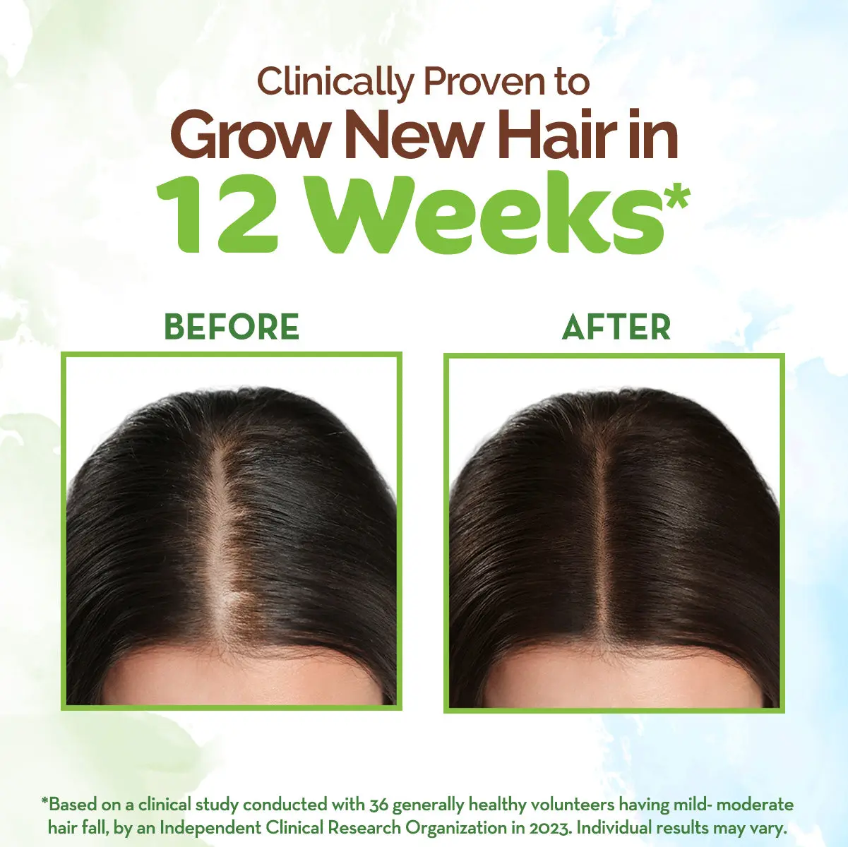 Mamaearth Rosemary Oil For Hair Growth - Image 3